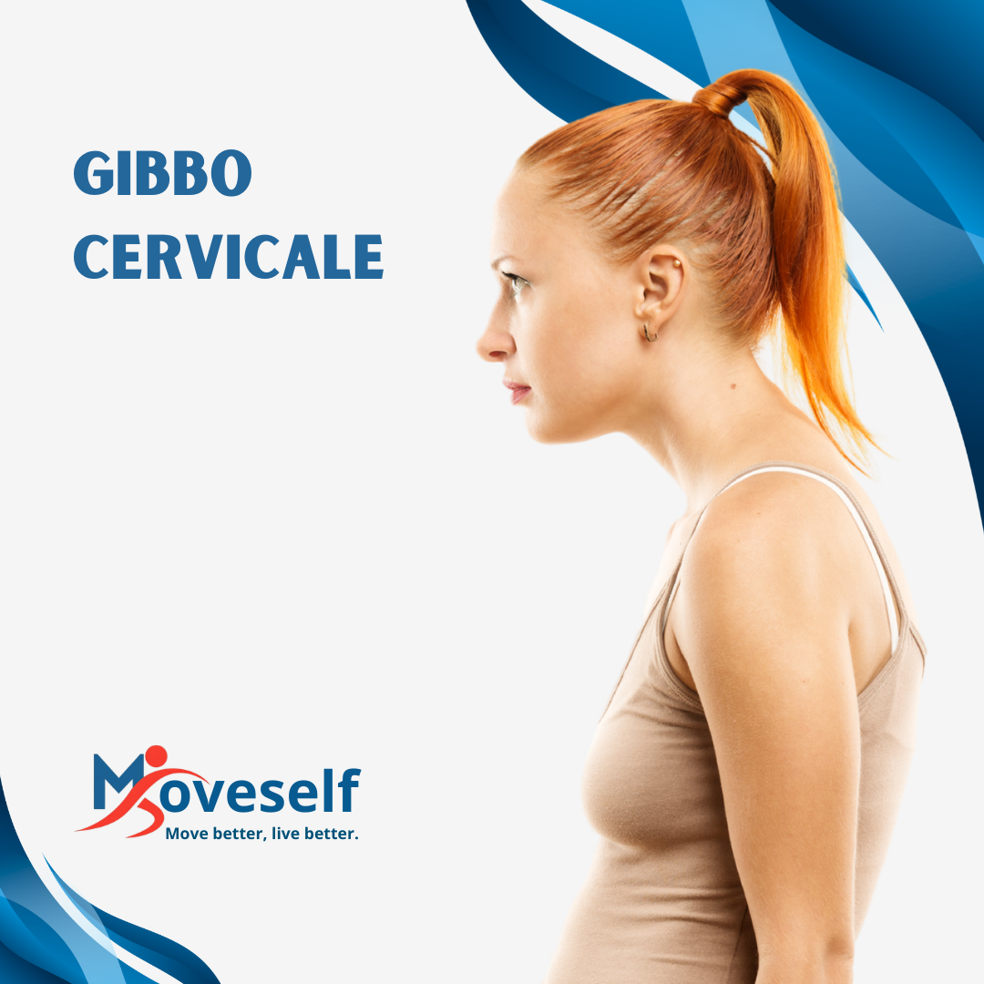 Gibbo cervicale: correggi la postura del collo