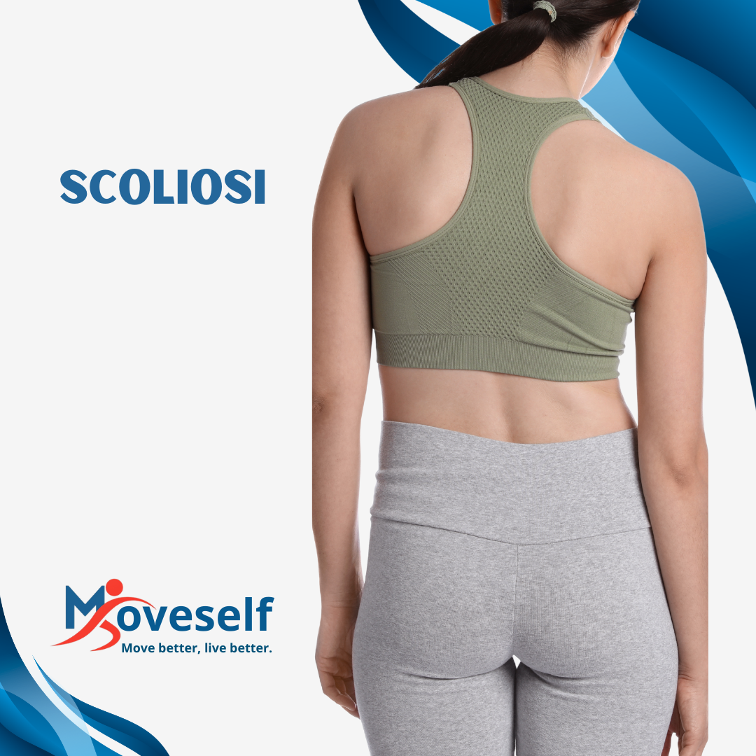 Scoliosi: migliora la postura e riduci il dolore