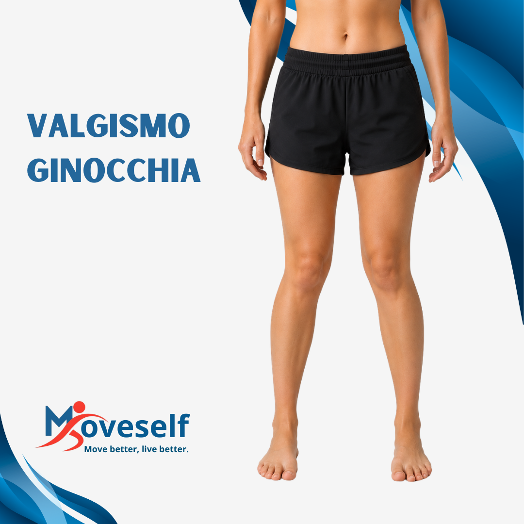 Valgismo ginocchia: riduci il dolore e migliora la postura
